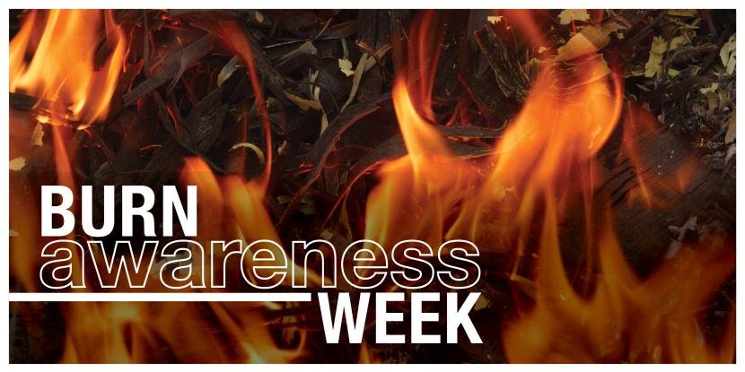 Fire Safety During Burn Awareness Week